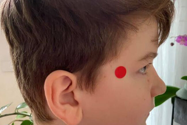 Akupressurpunkt ExKH5