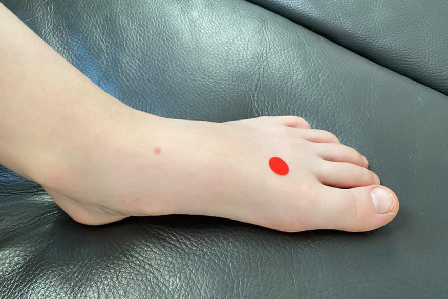 le3 Akupressurpunkt Le3