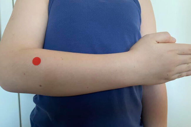 di10 Akupressurpunkt Di10