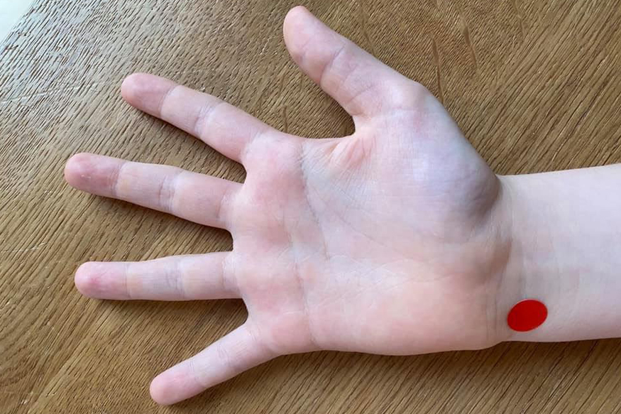 he7 Akupressurpunkt He7